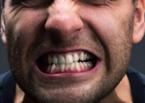 Grinding Teeth, Bruxism
