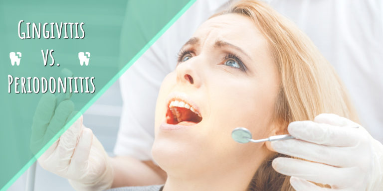 periodontitis gingivitis
