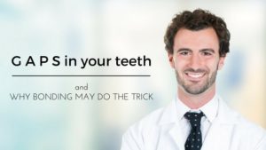 Gaps in Your Teeth and Why Bonding May Do the Trick