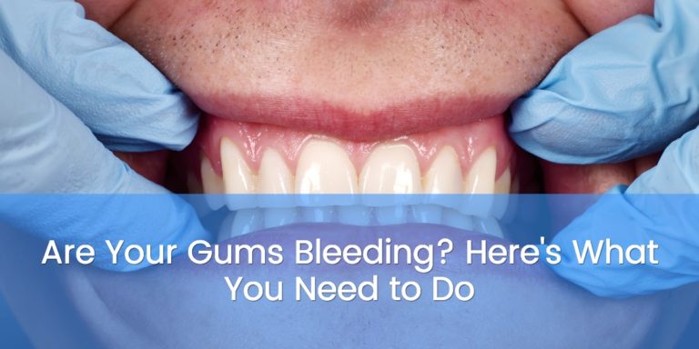 are your gums bleeding