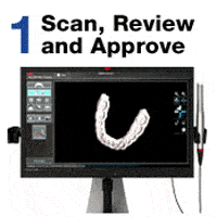 screen of dentist scan