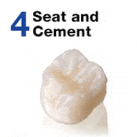 tooth with cement covering it
