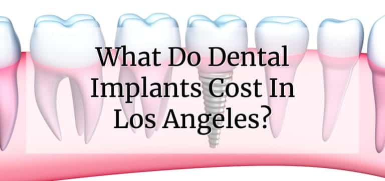 what do dental implants cost in los angeles