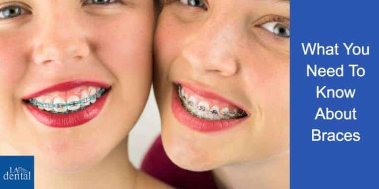 What You Need To Know About Braces
